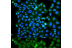 Immunofluorescence analysis of A549 cells using RNF125 Polyclonal Antibody (RNF125 抗体)