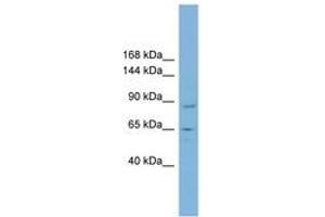 Image no. 1 for anti-TBC1 Domain Containing Kinase (TBCK) (AA 287-336) antibody (ABIN6742114) (TBCK 抗体  (AA 287-336))