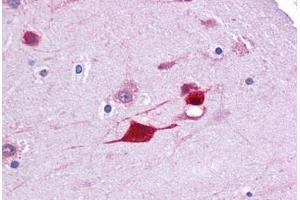 Human Brain, Cortex: Formalin-Fixed, Paraffin-Embedded (FFPE) (FABP4 抗体  (AA 71-120))