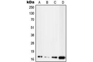 Western blot analysis of UBE2D2 expression in MCF7 (A), HepG2 (B), NIH3T3 (C), H9C2 (D) whole cell lysates. (UBE2D2 抗体  (C-Term))