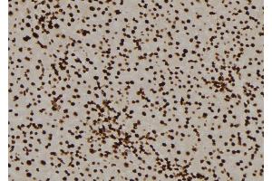 ABIN6276477 at 1/100 staining Mouse liver tissue by IHC-P. (PPP3CA 抗体  (N-Term))