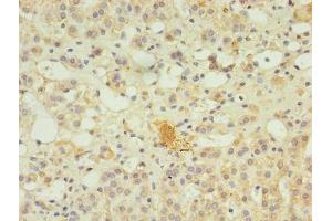 Immunohistochemistry of paraffin-embedded human adrenal gland tissue using ABIN7169349 at dilution of 1:100 (SERPINB8 抗体  (AA 60-242))
