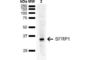 Western blot analysis of Rat Liver showing detection of ~35 kDa SFRP1 protein using Rabbit Anti-SFRP1 Polyclonal Antibody (ABIN5667734). (SFRP1 抗体  (AA 1-100) (FITC))