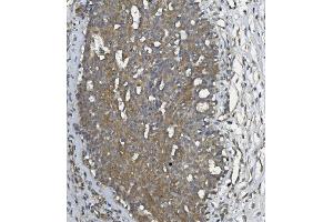 IHC analysis of ULBP1 using anti ULBP1 antibody (ABIN7600996). (ULBP1 抗体  (AA 27-209))