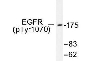 Image no. 1 for anti-Epidermal Growth Factor Receptor (EGFR) (pSer1070) antibody (ABIN318325) (EGFR 抗体  (pSer1070))