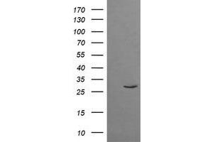 Image no. 1 for anti-Tripartite Motif Containing 38 (TRIM38) (AA 1-265) antibody (ABIN1490688) (TRIM38 抗体  (AA 1-265))