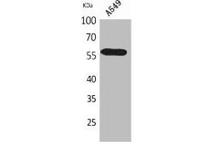 Western Blot analysis of A549 cells using ALDH2 Polyclonal Antibody. (ALDH2 抗体  (N-Term))