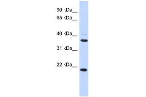 WB Suggested Anti-TMEM74 Antibody Titration: 0. (TMEM74 抗体  (Middle Region))