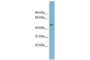 TMLHE antibody used at 1 ug/ml to detect target protein. (TMLHE 抗体  (Middle Region))