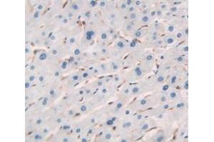 IHC-P analysis of Human Tissue, with DAB staining. (RGS4 抗体  (AA 38-205))