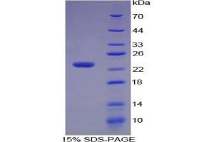 SDS-PAGE of Protein Standard from the Kit  (Highly purified E. (MMP3 ELISA 试剂盒)