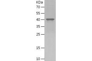 Western Blotting (WB) image for Pleckstrin Homology Domain Containing, Family B (Evectins) Member 1 (PLEKHB1) (AA 30-199) protein (His-IF2DI Tag) (ABIN7124485) (PLEKHB1 Protein (AA 30-199) (His-IF2DI Tag))