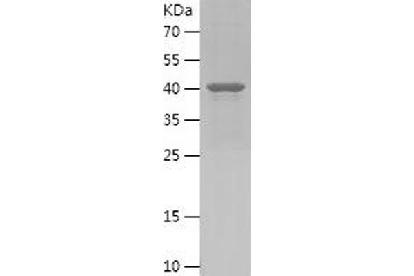 PLEKHB1 Protein (AA 30-199) (His-IF2DI Tag)