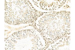 ABIN6258847 and ABIN6275709 at 1/100 staining Rat testis tissue by IHC-P. (RAD23B 抗体  (N-Term))