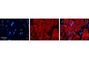 Rabbit Anti-CPT2 Antibody   Formalin Fixed Paraffin Embedded Tissue: Human heart Tissue Observed Staining: Cytoplasmic in mitochondria Primary Antibody Concentration: 1:100 Other Working Concentrations: 1:600 Secondary Antibody: Donkey anti-Rabbit-Cy3 Secondary Antibody Concentration: 1:200 Magnification: 20X Exposure Time: 0. (CPT2 抗体  (N-Term))