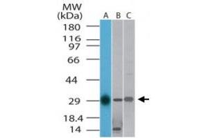 Western blot analysis of TLX1 in A) human, B) mouse and C) rat liver lysate. (TLX1 抗体  (AA 300-330))