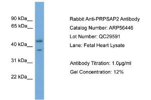 WB Suggested Anti-PRPSAP2  Antibody Titration: 0. (PRPSAP2 抗体  (Middle Region))