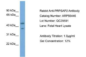 WB Suggested Anti-PRPSAP2  Antibody Titration: 0. (PRPSAP2 抗体  (Middle Region))