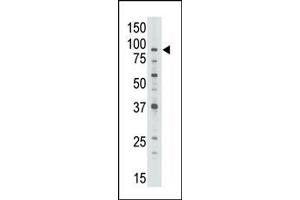 Image no. 1 for anti-ATP-Binding Cassette, Sub-Family B (MDR/TAP), Member 7 (ABCB7) (C-Term) antibody (ABIN358593)