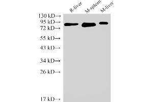 Western Blot analysis of Rat liver, Mouse spleen and Mouse liver using IL6R Polyclonal Antibody at dilution of 1:2000 (IL-6 Receptor 抗体)