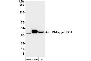 Western Blotting (WB) image for anti-His Tag antibody (ABIN7795586)