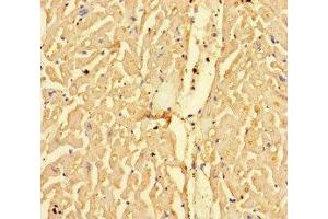 Immunohistochemistry of paraffin-embedded human heart tissue using ABIN7146833 at dilution of 1:100 (CPT1A 抗体  (AA 301-600))