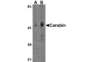 Western Blotting (WB) image for anti-TBC1 Domain Family, Member 10C (TBC1D10C) (N-Term) antibody (ABIN2477883)