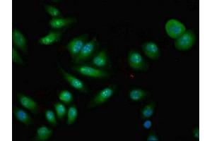 Immunofluorescent analysis of A549 cells using ABIN7148523 at dilution of 1:100 and Alexa Fluor 488-congugated AffiniPure Goat Anti-Rabbit IgG(H+L) (Copine IV 抗体  (AA 1-280))