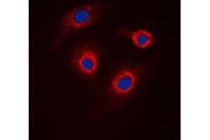 Immunofluorescent analysis of GCNT7 staining in HeLa cells. (GCNT7 抗体  (C-Term))