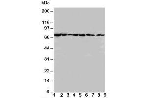 Western blot testing of Hsc70 antibody and Lane 1:  rat testis;  2: rat brain;  3: rat liver;  4: rat lung;  5: CEM;  6: HeLa;  7: SMMC-7721;  8: HT1080;  9: COLO320 cell lysate (Hsc70 抗体  (N-Term))