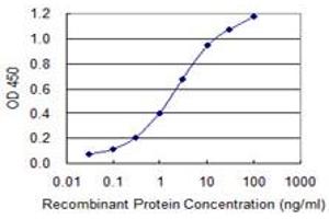 Detection limit for recombinant GST tagged FTCD is 0. (FTCD 抗体  (AA 440-541))