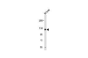 Anti-M Sema5a Antibody (N-term) at 1:1000 dilution + Mouse liver tissue lysate Lysates/proteins at 20 μg per lane. (SEMA5A 抗体  (N-Term))