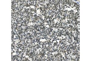 IHC analysis of HOXD11 using anti-HOXD11 antibody (ABIN7603174). (HOXD11 抗体  (N-Term))