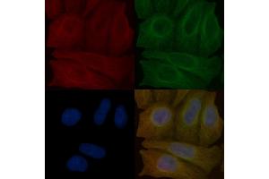 GSDMA Mouse Monoclonal Antibody staining Hela cells by IF/ICC.