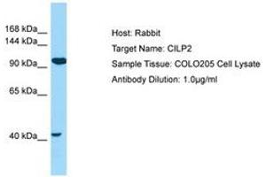 Image no. 1 for anti-Cartilage Intermediate Layer Protein 2 (Cilp2) (AA 112-161) antibody (ABIN6750043)