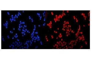 IF analysis of NR3C1 using anti- NR3C1 antibody (ABIN3043453).