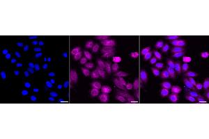 Immunocytochemical staining of HepG2 cells with Huntingtin antibody (ABIN7799005), 1:1,000). (Recombinant Huntingtin 抗体)