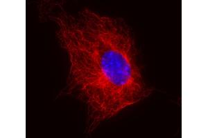 Immunofluorescence staining (mouse fibroblasts) Immunofluorescence staining of 3T3 mouse embryonal fibroblast cell line using anti-beta-tubulin (TU-06) (detection by Goat anti-mouse IgM Cy®5). (TUBB 抗体)