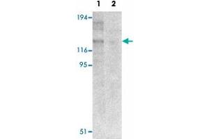 Western blot analysis of NLRP8 in human colon tissue lysate with NLRP8 polyclonal antibody  at 1 ug/mL in (1) the absence and (2) the presence of blocking peptide. (NALP8 抗体  (N-Term))