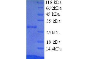 Paraneoplastic Antigen MA2 (PNMA2) (AA 2-364) protein (His tag) (PNMA2 Protein (AA 2-364) (His tag))