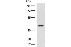 Western blot analysis of K562 and HepG2 cell lysates using RBM4 Polyclonal Antibody at dilution of 1:750 (RBM4 抗体)