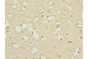 Immunohistochemistry of paraffin-embedded human brain tissue using ABIN7147433 at dilution of 1:100 (CCDC41 抗体  (AA 34-260))