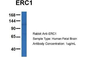 Host: Rabbit  Target Name: ERC1  Sample Tissue: Human Fetal Brain  Antibody Dilution: 1. (ERC1 抗体  (C-Term))