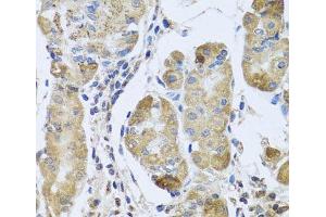 Immunohistochemistry of paraffin-embedded Human stomach using EFHC1 Polyclonal Antibody at dilution of 1:100 (40x lens). (EFHC1 抗体)