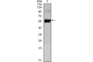 Western blot analysis using PAX6 mAb against human PAX6 (AA: 1-223) recombinant protein. (PAX6 抗体)