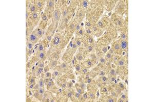 Immunohistochemistry of paraffin-embedded human liver damage using PEX5 antibody (ABIN6133015, ABIN6145469, ABIN6145471 and ABIN6221464) at dilution of 1:100 (40x lens). (PEX5 抗体  (AA 1-260))
