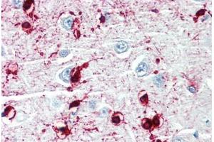 Human Brain, Cortex (formalin-fixed, paraffin-embedded) stained with CRYAB antibody ABIN462098 at 10 µg/ml followed by biotinylated goat anti-rabbit IgG secondary antibody ABIN481713, alkaline phosphatase-streptavidin and chromogen. (CRYAB 抗体)