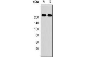 Western blot analysis of KIF1B expression in Hela (A), SKOV3 (B) whole cell lysates. (KIF1B 抗体)