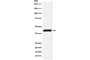 Western blot analysis of ALKBH1 expression in Jurkat cell lysate. (Recombinant ALKBH1 抗体)