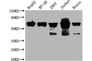 Western Blot Positive WB detected in: HepG2 whole cell lysate, HT-29 whole cell lysate, 293T whole cell lysate, Jurkat whole cell lysate, Mouse brain tissue All lanes: DDX5 antibody at 1:2000 Secondary Goat polyclonal to rabbit IgG at 1/50000 dilution Predicted band size: 70, 61 kDa Observed band size: 70 kDa (Recombinant DDX5 抗体)